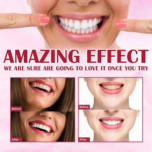 Yayashi SP4 Probiotic Toothpaste 120g